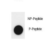 KDM4A / JHDM3A / JMJD2A Antibody - Dot blot of anti-Phospho-JMJD2A-Y547 Phospho-specific antibody on nitrocellulose membrane. 50ng of Phospho-peptide or Non Phospho-peptide per dot were adsorbed. Antibody working concentrations are 0.5ug per ml.