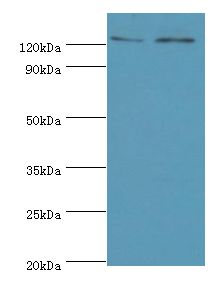 KDM4B / JMJD2B Antibody - Western blot. All lanes: KDM4B antibody at 4 ug/ml. Lane 1: Jurkat whole cell lysate. Lane 2: k562 whole cell lysate. Secondary antibody: Goat polyclonal to rabbit at 1:10000 dilution. Predicted band size: 122 kDa. Observed band size: 122 kDa.