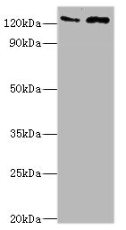 KDM4B / JMJD2B Antibody - Western blot All lanes: KDM4B antibody at 4µg/ml Lane 1: Jurkat whole cell lysate Lane 2: k562 whole cell lysate Secondary Goat polyclonal to rabbit IgG at 1/10000 dilution Predicted band size: 122, 51 kDa Observed band size: 122 kDa