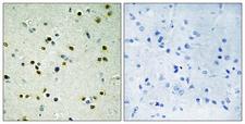 KDM4B / JMJD2B Antibody - Immunohistochemistry analysis of paraffin-embedded human brain, using JHD3B Antibody. The picture on the right is blocked with the synthesized peptide.