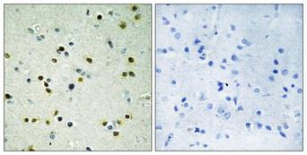 KDM4B / JMJD2B Antibody - Peptide - + Immunohistochemistry analysis of paraffin-embedded human brain tissue, using JHD3B antibody.