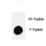 KDM4B / JMJD2B Antibody - Dot blot of anti-Phospho-JMJD2B-S566 Phospho-specific antibody on nitrocellulose membrane. 50ng of Phospho-peptide or Non Phospho-peptide per dot were adsorbed. Antibody working concentrations are 0.6ug per ml.