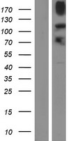 KDM4B / JMJD2B Protein - Western validation with an anti-DDK antibody * L: Control HEK293 lysate R: Over-expression lysate
