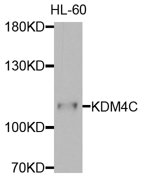 KDM4C / JMJD2C Antibody - Western blot analysis of extracts of HL-60 cells.