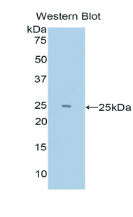 KDM4C / JMJD2C Antibody - Western blot of recombinant KDM4C / JMJD2C.  This image was taken for the unconjugated form of this product. Other forms have not been tested.