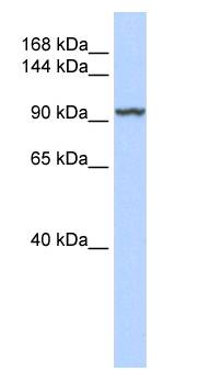 KDM4C / JMJD2C Antibody - Western blot of HepG2 cell lysate using KDM4C / JMJD2C Antibody at 1 ug/ml. This image was taken for the unconjugated form of this product. Other forms have not been tested.