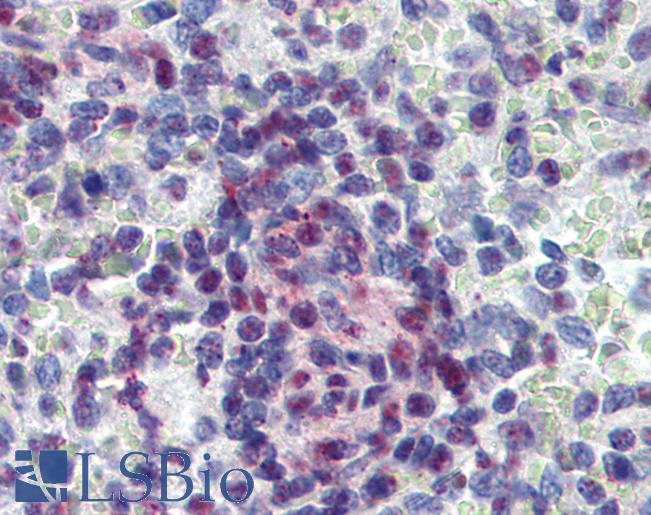 KDM4C / JMJD2C Antibody - Anti-JMJD2C antibody IHC of human spleen. Immunohistochemistry of formalin-fixed, paraffin-embedded tissue after heat-induced antigen retrieval. Antibody concentration 5 ug/ml.  This image was taken for the unconjugated form of this product. Other forms have not been tested.