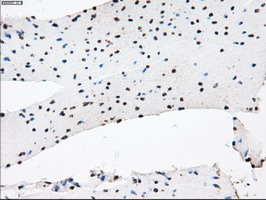 KDM4C / JMJD2C Antibody - IHC of paraffin-embedded colon tissue using anti-KDM4C mouse monoclonal antibody. (Dilution 1:50).