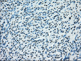 KDM4C / JMJD2C Antibody - IHC of paraffin-embedded endometrium tissue using anti-KDM4C mouse monoclonal antibody. (Dilution 1:50).