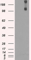 KDM4C / JMJD2C Antibody - HEK293T cells were transfected with the pCMV6-ENTRY control (Left lane) or pCMV6-ENTRY KDM4C (Right lane) cDNA for 48 hrs and lysed. Equivalent amounts of cell lysates (5 ug per lane) were separated by SDS-PAGE and immunoblotted with anti-KDM4C.