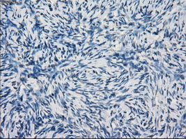 KDM4C / JMJD2C Antibody - Immunohistochemical staining of paraffin-embedded Ovary tissue using anti-KDM4C mouse monoclonal antibody. (Dilution 1:50).