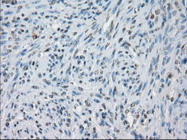 KDM4C / JMJD2C Antibody - Immunohistochemical staining of paraffin-embedded endometrium tissue using anti-KDM4C mouse monoclonal antibody. (Dilution 1:50).