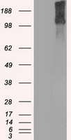KDM4C / JMJD2C Antibody - HEK293T cells were transfected with the pCMV6-ENTRY control (Left lane) or pCMV6-ENTRY KDM4C (Right lane) cDNA for 48 hrs and lysed. Equivalent amounts of cell lysates (5 ug per lane) were separated by SDS-PAGE and immunoblotted with anti-KDM4C.