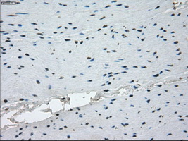 KDM4C / JMJD2C Antibody - IHC of paraffin-embedded colon tissue using anti-KDM4C mouse monoclonal antibody. (Dilution 1:50).
