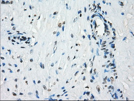 KDM4C / JMJD2C Antibody - IHC of paraffin-embedded prostate tissue using anti-KDM4C mouse monoclonal antibody. (Dilution 1:50).