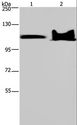 KDM4C / JMJD2C Antibody - Western blot analysis of Mouse heart and brain tissue, using KDM4C Polyclonal Antibody at dilution of 1:800.