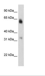 KDM4D / JMJD2D Antibody - Fetal Brain Lysate.  This image was taken for the unconjugated form of this product. Other forms have not been tested.