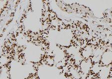 KDM4D / JMJD2D Antibody - 1:100 staining rat lung tissue by IHC-P. The sample was formaldehyde fixed and a heat mediated antigen retrieval step in citrate buffer was performed. The sample was then blocked and incubated with the antibody for 1.5 hours at 22°C. An HRP conjugated goat anti-rabbit antibody was used as the secondary.