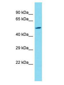 KDM4E Antibody - KDM4E antibody Western Blot of 721_B. Antibody dilution: 1 ug/ml.  This image was taken for the unconjugated form of this product. Other forms have not been tested.