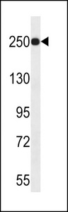 KDM5A / JARID1A Antibody - JARID1A Antibody western blot of uterus tumor cell line lysates (35 ug/lane). The JARID1A antibody detected the JARID1A protein (arrow).