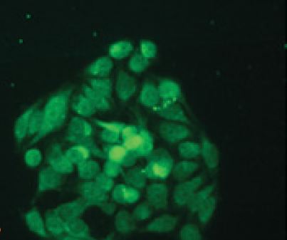 KDM5B / JARID1B Antibody - Immunofluorescent staining of HeLa cells with JARID1 antibody (10 ug/ml)