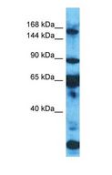 KDM5B / JARID1B Antibody - Western blot of KDM5B Antibody with human HepG2 Whole Cell lysate.  This image was taken for the unconjugated form of this product. Other forms have not been tested.