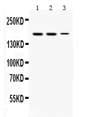 KDM5B / JARID1B Antibody - Western blot - Anti-KDM5B/Jarid1B Picoband Antibody