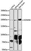 KDM5B / JARID1B Antibody - Western blot analysis of extracts of various cell lines, using KDM5B antibody at 1:1000 dilution. The secondary antibody used was an HRP Goat Anti-Rabbit IgG (H+L) at 1:10000 dilution. Lysates were loaded 25ug per lane and 3% nonfat dry milk in TBST was used for blocking. An ECL Kit was used for detection and the exposure time was 90s.