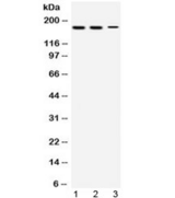 KDM5B / JARID1B Antibody - Western blot testing of 1) rat testis, 2) mouse testis and 3) human HepG2 lysate with KDM5B antibody at 0.5ug/ml. Predicted/observed molecular weight: ~176 kDa.