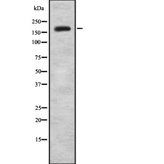 KDM5B / JARID1B Antibody - Western blot analysis of JAD1B expression in HEK293 cells. The lane on the left is treated with the antigen-specific peptide.