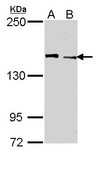 KDM5C / Jarid1C / SMCX Antibody - Sample (30 ug of whole cell lysate). A: A431. B: Hela. 5% SDS PAGE. JARID1C antibody diluted at 1:1000. 