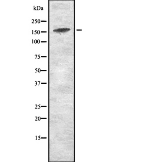 KDM5D / JARID1D Antibody - Western blot analysis of JAD1D expression in HEK293 cells. The lane on the left is treated with the antigen-specific peptide.