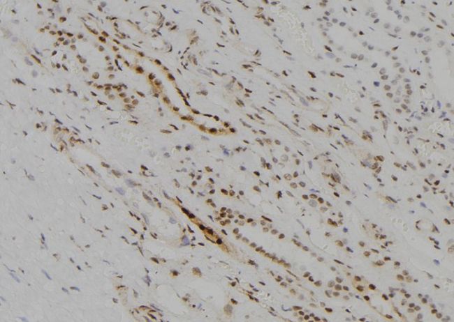 KDM5D / JARID1D Antibody - 1:100 staining human kidney tissue by IHC-P. The sample was formaldehyde fixed and a heat mediated antigen retrieval step in citrate buffer was performed. The sample was then blocked and incubated with the antibody for 1.5 hours at 22°C. An HRP conjugated goat anti-rabbit antibody was used as the secondary.