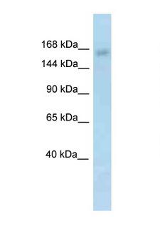 KDM6A / UTX Antibody - KDM6A / UTX antibody Western blot of Mouse Intestine lysate. Antibody concentration 1 ug/ml.  This image was taken for the unconjugated form of this product. Other forms have not been tested.