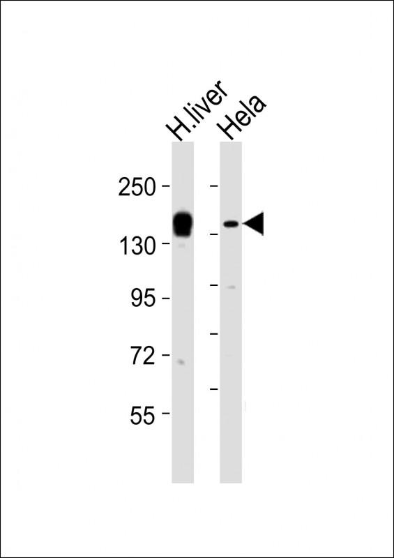 KDM6A / UTX Antibody - All lanes : Anti-KDM6A Antibody at 1:2000 dilution Lane 1: human liver lysates Lane 2: HeLa whole cell lysates Lysates/proteins at 20 ug per lane. Secondary Goat Anti-Rabbit IgG, (H+L), Peroxidase conjugated at 1/10000 dilution Predicted band size : 154 kDa Blocking/Dilution buffer: 5% NFDM/TBST.