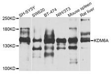 KDM6A / UTX Antibody - Western blot blot of extracts of various cell lines, using KDM6A antibody.