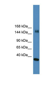KDM6A / UTX Antibody - KDM6A / UTX antibody Western blot of HeLa lysate. This image was taken for the unconjugated form of this product. Other forms have not been tested.