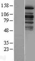 KDM6A / UTX Protein - Western validation with an anti-DDK antibody * L: Control HEK293 lysate R: Over-expression lysate