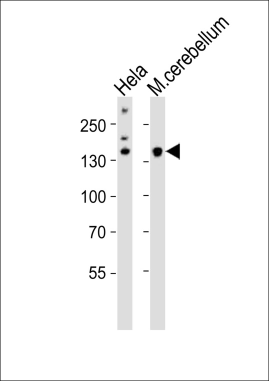 KDM6B / JMJD3 Antibody - Western blot of lysates from HeLa cell line, mouse cerebellum tissue (from left to right) with Mouse Kdm6b Antibody. Antibody was diluted at 1:1000 at each lane. A goat anti-rabbit IgG H&L (HRP) at 1:10000 dilution was used as the secondary antibody. Lysates at 20 ug per lane.