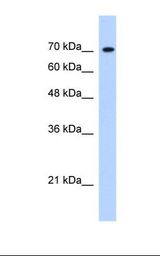 KDM6B / JMJD3 Antibody - HepG2 cell lysate. Antibody concentration: 1.25 ug/ml. Gel concentration: 12%.  This image was taken for the unconjugated form of this product. Other forms have not been tested.