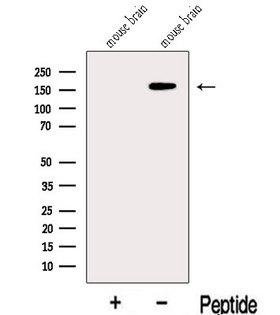 KDM6B / JMJD3 Antibody - Western blot analysis of extracts of mouse brain tissue using JMJD3 antibody. The lane on the left was treated with blocking peptide.