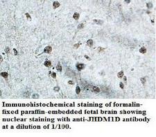 KDM7A / JHDM1D Antibody