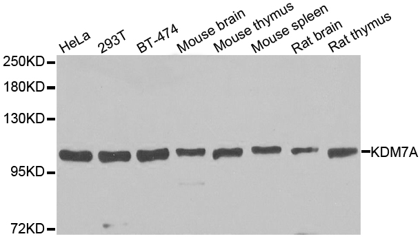 KDM7A / JHDM1D Antibody - Western blot analysis of extracts of various cell lines.