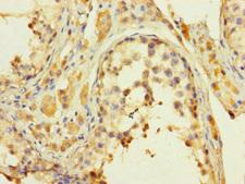 KDM8 / JMJD5 / FLJ13798 Antibody - Immunohistochemistry of paraffin-embedded human testis tissue using KDM8 Antibody at dilution of 1:100