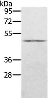 KDM8 / JMJD5 / FLJ13798 Antibody - Western blot analysis of Human normal stomach tissue, using KDM8 Polyclonal Antibody at dilution of 1:500.