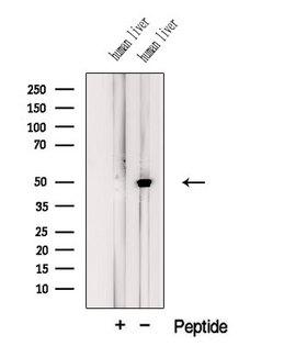 KDM8 / JMJD5 / FLJ13798 Antibody - Western blot analysis of extracts of human liver tissue using KDM8 antibody. The lane on the left was treated with blocking peptide.