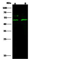 KDM8 / JMJD5 / FLJ13798 Antibody - Immunochemical staining of human KDM8 in human breast with rabbit polyclonal antibody (1:1000, formalin-fixed paraffin embedded sections).