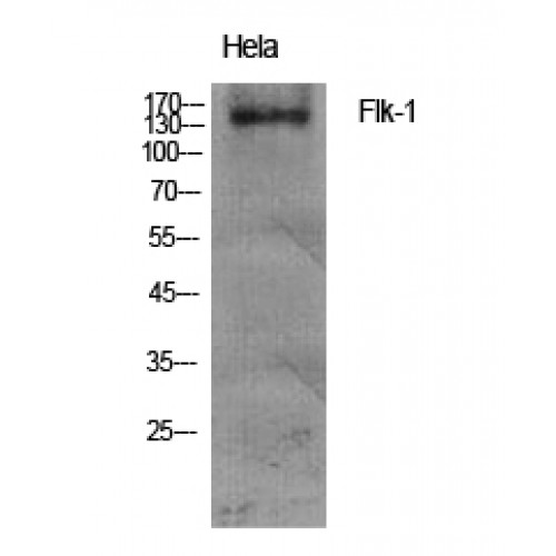 KDR / VEGFR2 / FLK1 Antibody - Western blot of Flk-1 antibody