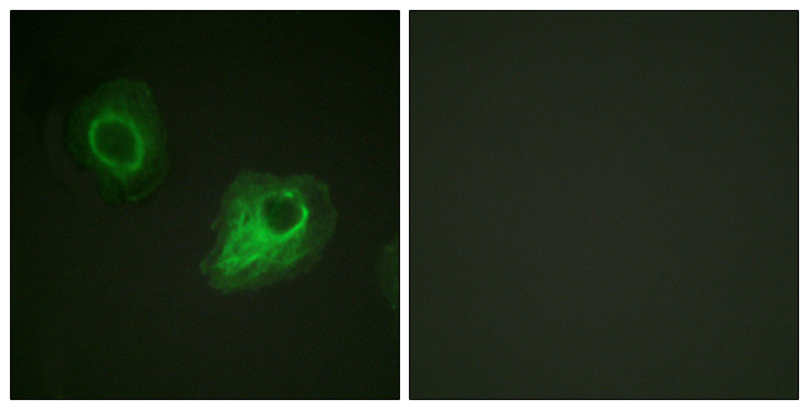 KDR / VEGFR2 / FLK1 Antibody - Immunofluorescence analysis of HeLa cells, using VEGFR2 Antibody. The picture on the right is blocked with the synthesized peptide.