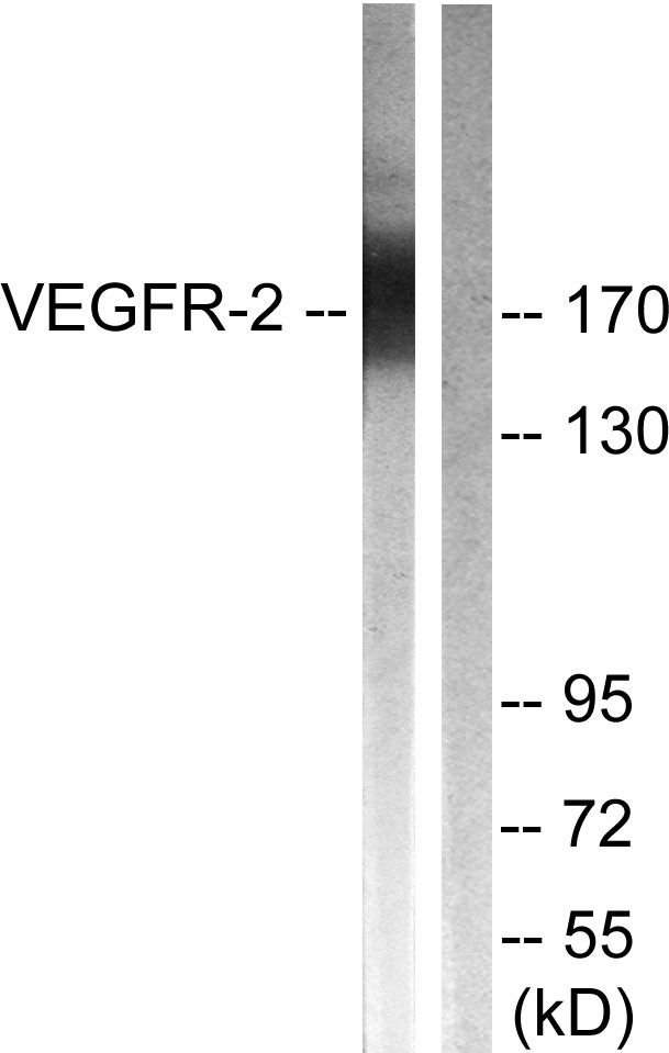 KDR / VEGFR2 / FLK1 Antibody - Western blot analysis of lysates from HepG2 cells, treated with Na3VO4 0.3nM 40', using VEGFR2 Antibody. The lane on the right is blocked with the synthesized peptide.